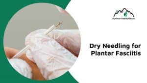 dry needling for plantar fasciitis Calgary nw