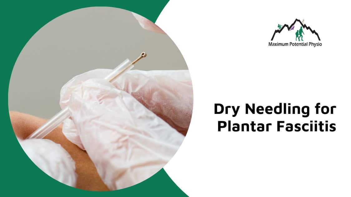 Relieve Your Plantar Fasciitis Pain With Dry Needling