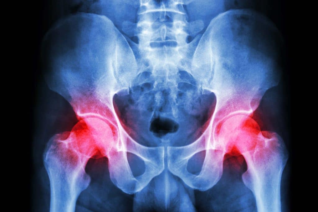 pelvic floor physiotherapy for pelvic girdle pain