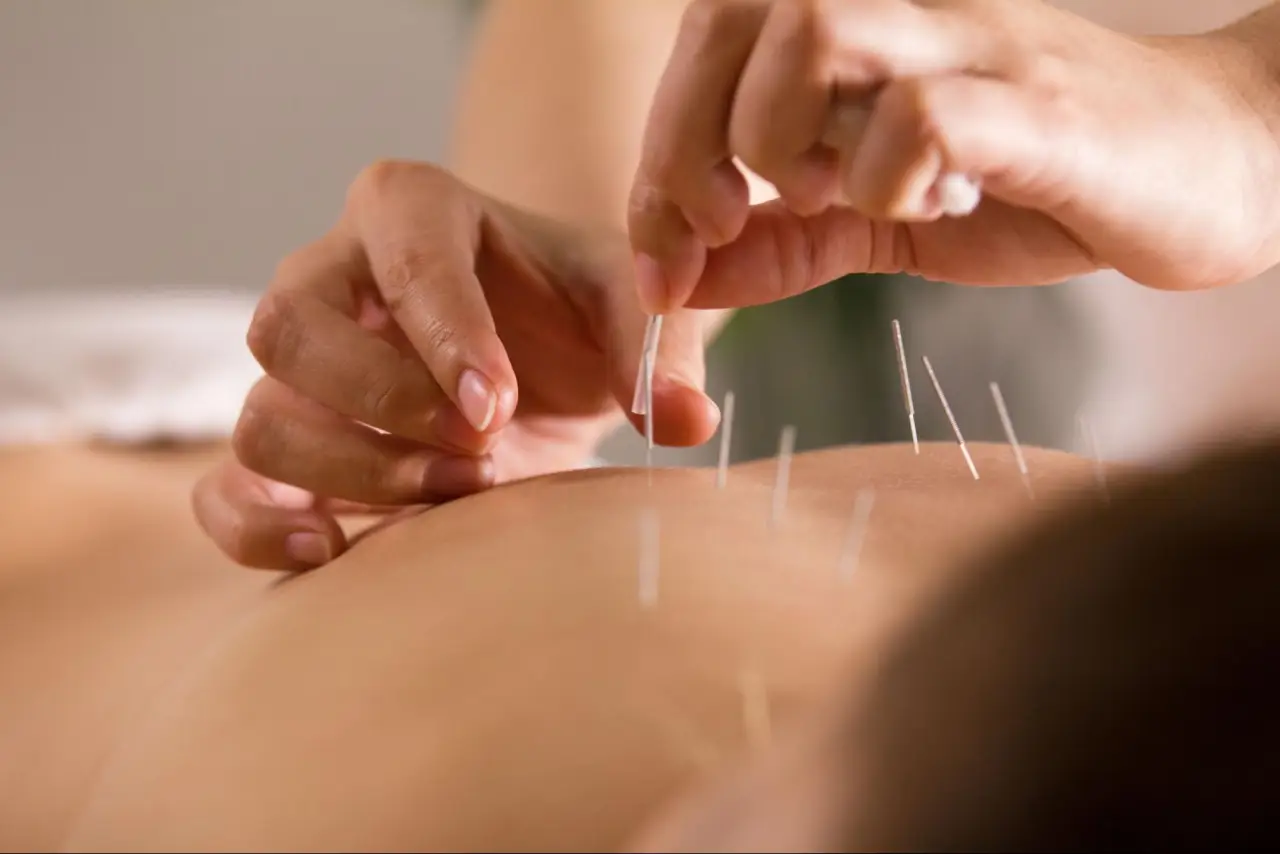 Acupuncture Conditions